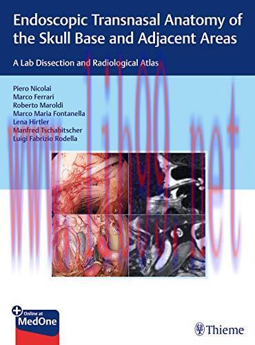 [AME]Endoscopic Transnasal Anatomy of the Skull Base and Adjacent Areas: A Lab Dissection and R...