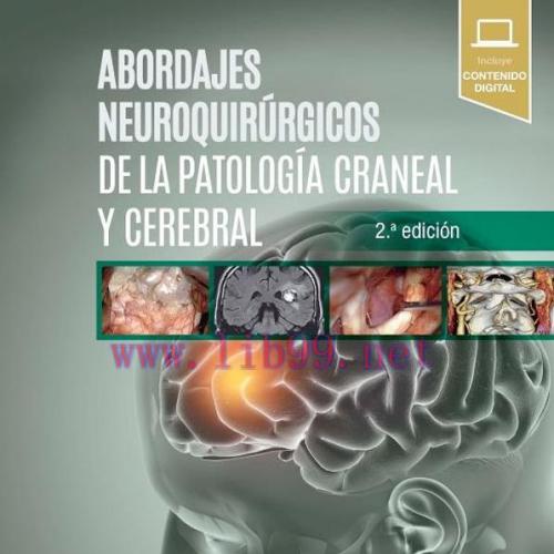 [AME]Abordajes neuroquir&uacute;rgicos de la patolog&iacute;a craneal y cerebral, 2.&ordf; edici&oacute;n (True PDF)