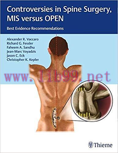 [PDF]Controversies in Spine Surgery, MIS versus OPEN