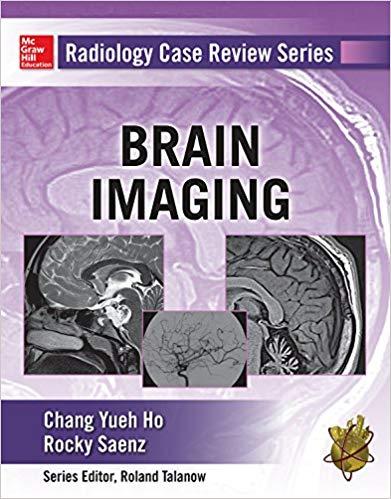 Radiology Case Review Series - Brain Imaging