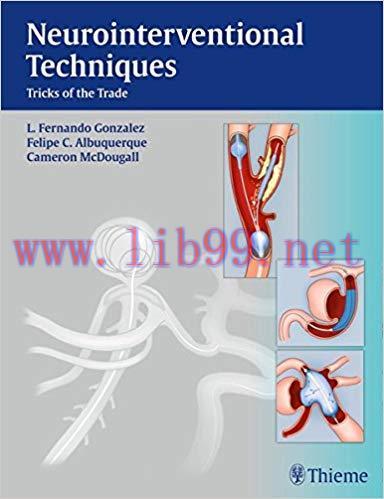 [PDF]Neurointerventional Techniques - Tricks of the Trade