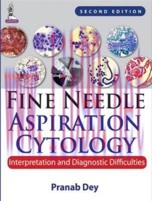 [AME]Fine Needle Aspiration Cytology : Interpretation and Diagnostic Difficulties, 2nd Edition