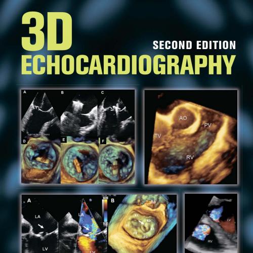 3D Echocardiography 2nd Edition - Shiota, Takahiro