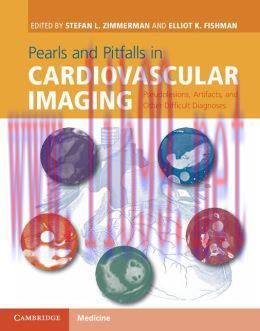 [AME]Pearls and Pitfalls in Cardiovascular Imaging: Pseudolesions, Artifacts, and Other Difficu...