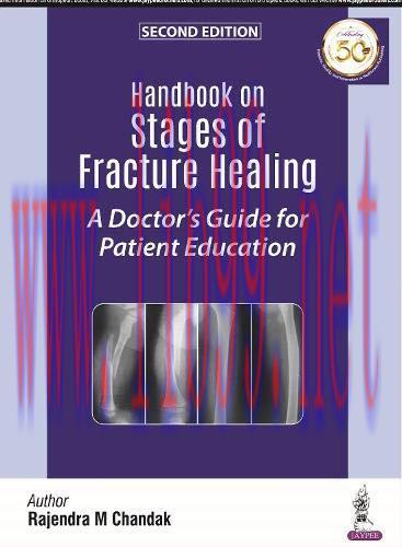 [AME]Handbook on Stages of Fracture Healing: A Doctor&rsquo;s Guide for Patient Education, 2nd Editio...