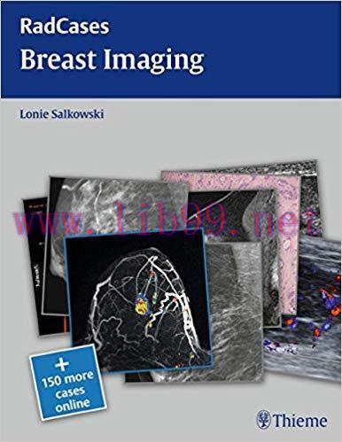 [PDF]RadCases Breast Imaging