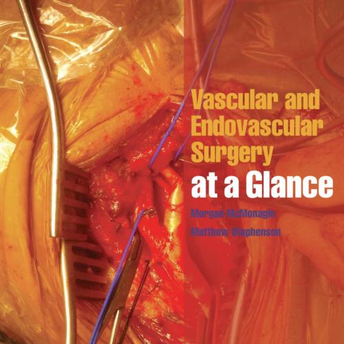 Vascular and Endovascular Surgery at a Glance