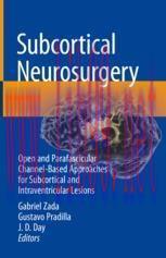[PDF]Subcortical Neurosurgery: Open and Parafascicular Channel-Based Approaches for Subcortical...