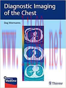 [AME]Diagnostic Imaging of the Chest (EPUB)