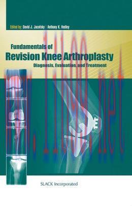 [AME]Fundamentals of Revision Knee Arthroplasty: Diagnosis, Evaluation, and Treatment (ORIGINAL...