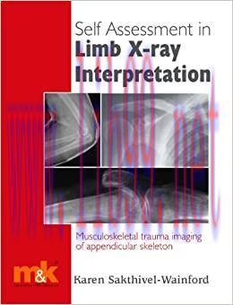 (PDF)Self Assessment in Limb X-ray Interpretation: Musculoskeletal Trauma Imaging of Appendicul...