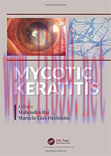 [PDF]Mycotic Keratitis