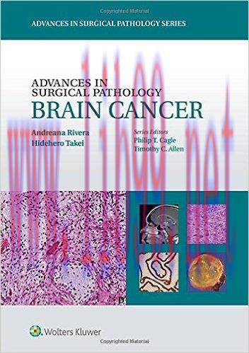 [AME]Advances in Surgical Pathology: Brain Cancer (EPUB)