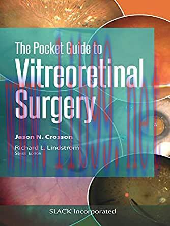 [PDF]The Pocket Guide to Vitreoretinal Surgery
