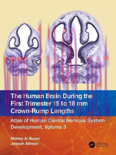 [AME]The Human Brain during the First Trimester 15- to 18-mm Crown-Rump Lengths: Atlas of Human...