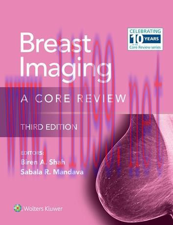 [AME]Breast Imaging (EPUB)