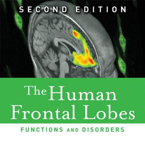 Human Frontal Lobes Functions and Disorders 2nd Edition, The - Wei Zhi