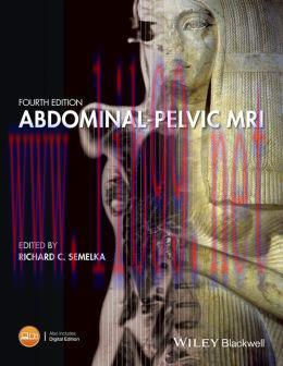 [AME]Abdominal-Pelvic MRI, 4th Edition