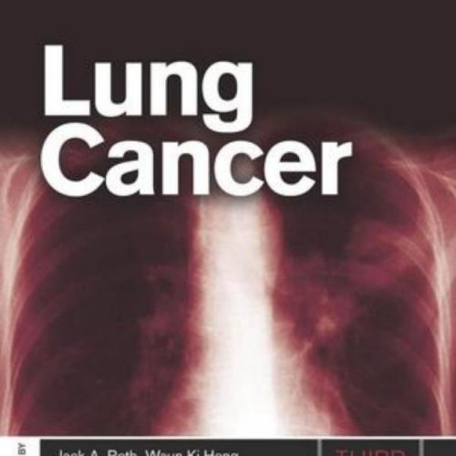 lung cancer_3rd ed - Wei Zhi