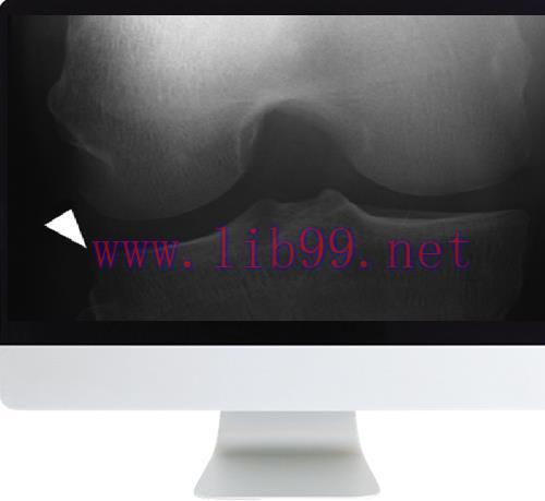 [AME]Musculoskeletal Imaging for the Practicing Radiologist 2018 (ARRS VIDEOS) (CME VIDEOS)