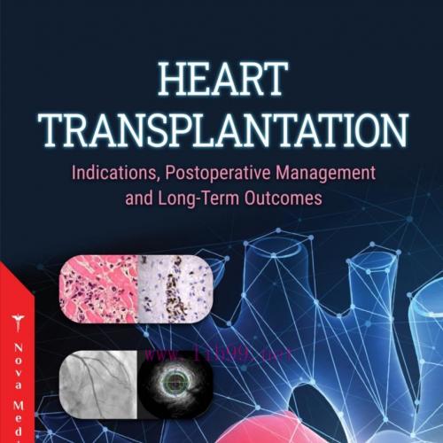 [AME]Heart Transplantation: Indications, Postoperative Management and Long-Term Outcomes (Origi...