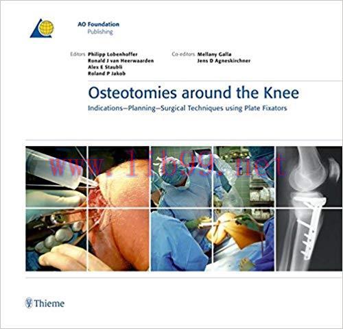 [PDF]Osteotomies around the Knee