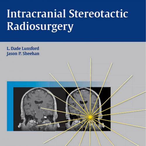 Intracranial Stereotactic Radiosurgery