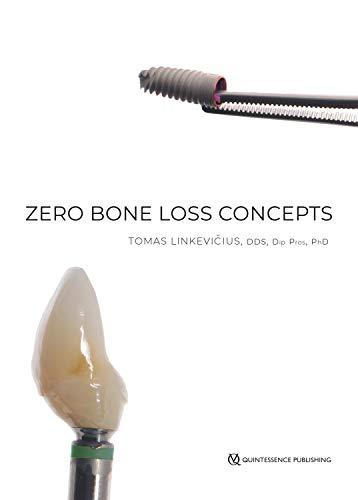 (PDF)Zero Bone Loss Concepts