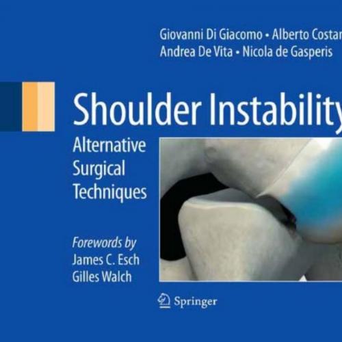 Shoulder Instability_ Alternative Surgical Techniques