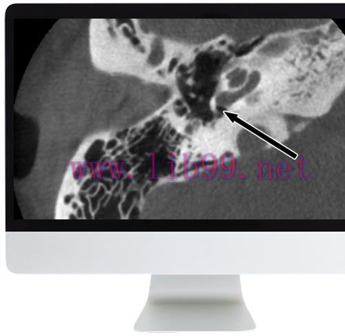 [AME]Deep Dive into Head and Neck Radiology 2020 (CME VIDEOS)