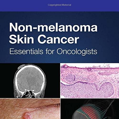 Non-melanoma Skin Cancer: Essentials for Oncologists (Series in Medical Physics and Biomedical ...