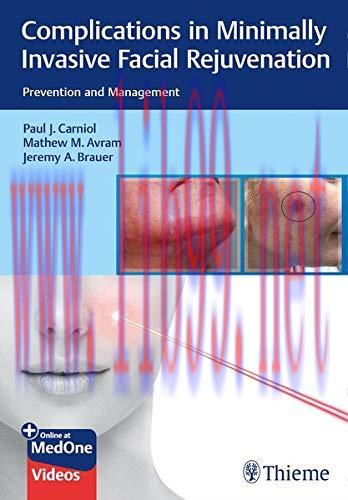 [AME]Complications in Minimally Invasive Facial Rejuvenation: Prevention and Management (Origin...
