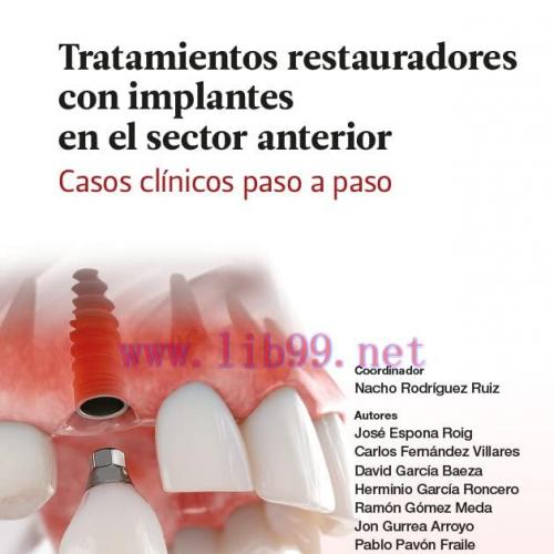 [AME]Tratamientos restauradores con implantes en el sector anterior. Casos cl&iacute;nicos paso a paso...