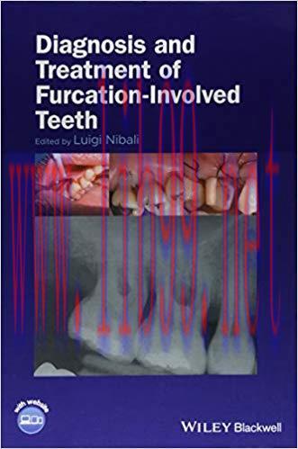 [PDF]Diagnosis and Treatment of Furcation-Involved Teeth