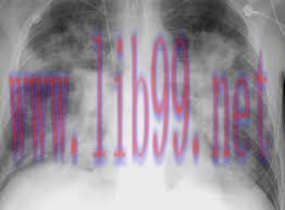 [AME]MRIOnline Imaging Mastery Series: Cardiopulmonary Imaging 2021 (CME VIDEOS)