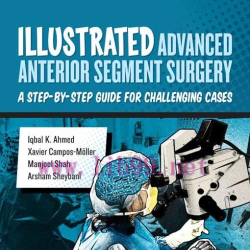 [AME]Illustrated Advanced Anterior Segment Surgery (EPUB)