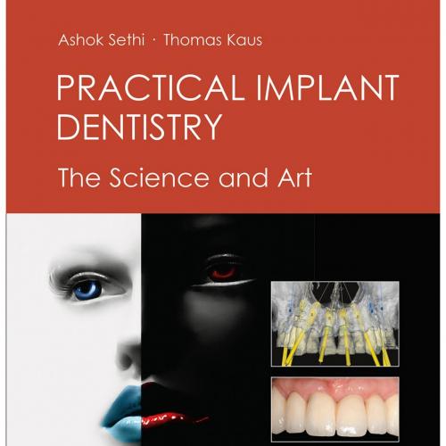 Practical Implant Dentistry The Science and Art