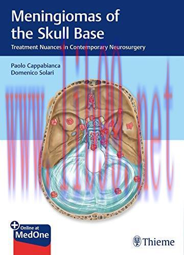 [AME]Meningiomas of the Skull Base: Treatment Nuances in Contemporary Neurosurgery (PDF)