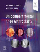 [PDF]Unicompartmental Knee Arthroplasty