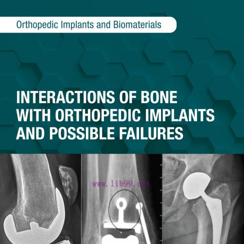 [AME]Interactions of Bone with Orthopedic Implants and Possible Failures (EPUB)