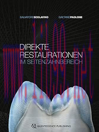 [AME]Direkte Restaurationen im Seitenzahnbereich (German Edition) (EPUB)
