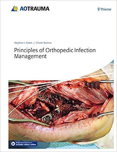 Principles of Orthopedic Infection Management + VIDEOS