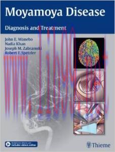 [AME]Moyamoya Disease: Diagnosis and Treatment