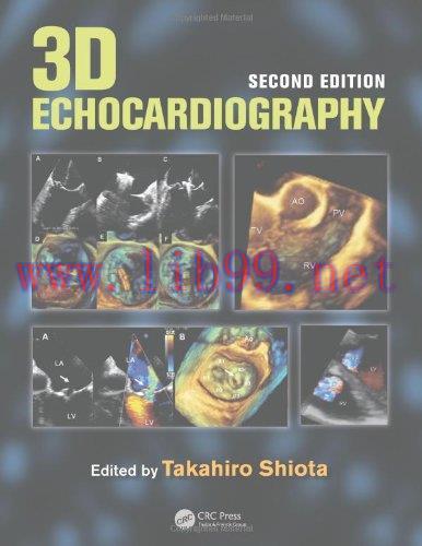 [AME]3D Echocardiography, 2nd Edition (Original PDF)