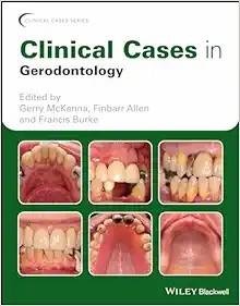 [AME]Clinical Cases in Gerodontology (Clinical Cases (Dentistry)) (Original PDF)