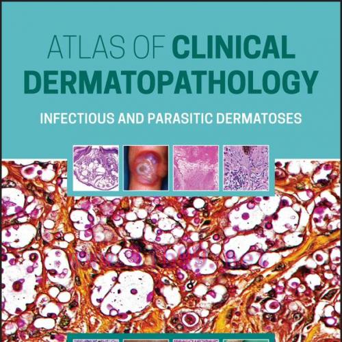 [AME]Atlas of Clinical Dermatopathology: Infectious and Parasitic Dermatoses (EPUB)