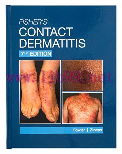 [AME]Fisher&rsquo;s Contact Dermatitis, 7th Edition (ePub+Converted PDF)