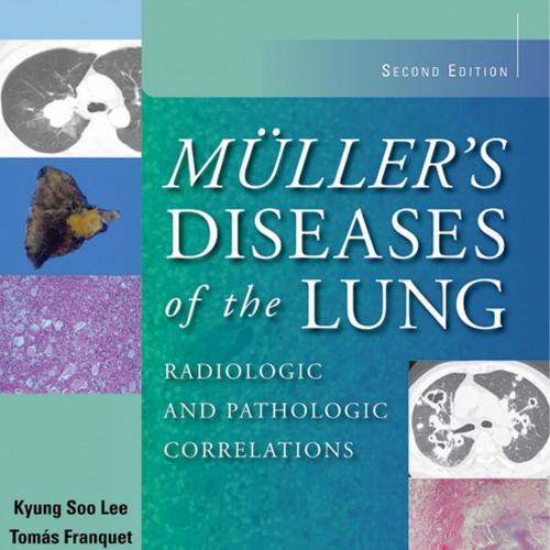 Muller's Diseases of the Lung-Radiologic and Pathologic Correlations, 2nd Edition