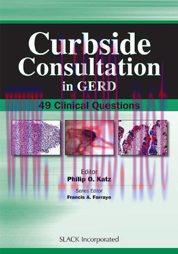 [AME]Curbside Consultation in GERD: 49 Clinical Questions