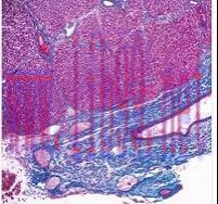 [AME]Current Topics in Gastrointestinal and Liver Pathology 2023 (John Hopkins) (Videos)